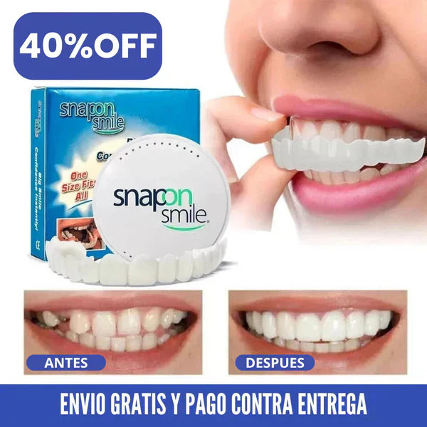 Carillas Smile™
