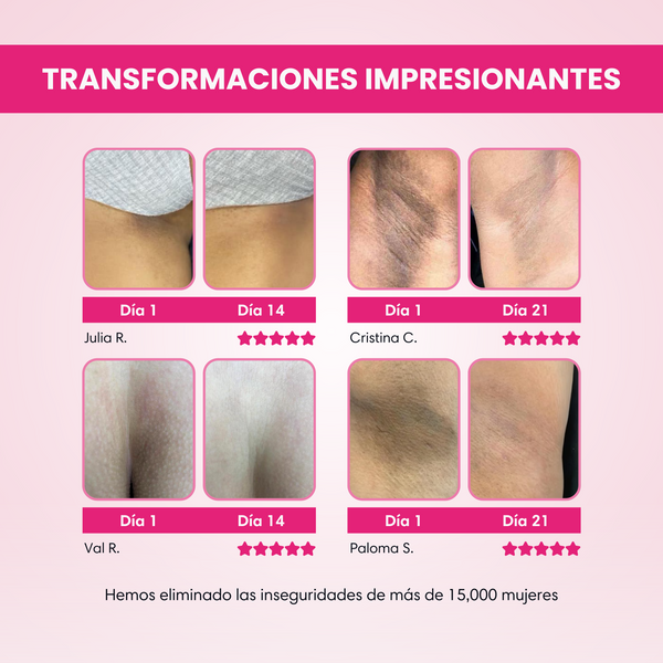 Crema Aclarante® LLEVAS 2 Y PAGAS 1 + Regalo